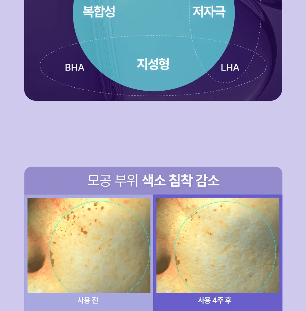 [모공PDRN]리쥬란 더마 힐러 포어 타이트닝 앰플 30ml [한정기획(+앰플10ml+패드10매)/기획/단품] 상세페이지 19